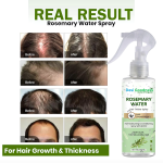 Desi Goodness Rosemary Water Spray for Hair Growth with Biotin, Hair Spray for Hair fall| Rosemary & Hair Mist  | Suitable For All Hair Types